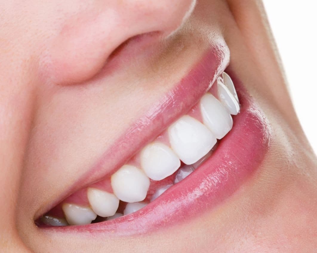 Transparente Aligner für kleinere und größere kieferorthopädische Probleme